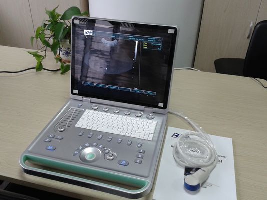 3D デジタルのラップトップのいろいろな種類の調査が付いている携帯用超音波の走査器